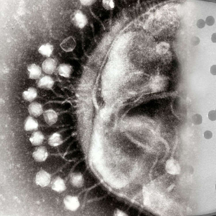 images my ideas 21/21 WC Emily Brown Bacteriophages_at_work.jpg